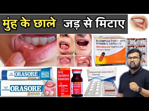 मुंह के छाले | Medicine | Mouth Ulcer | Ulcer Medicine | Pharmacy | Treatment | Doctor | MBBS