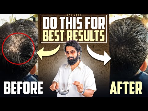 Reverse *HAIRFALL* Naturally🌿(5 steps)