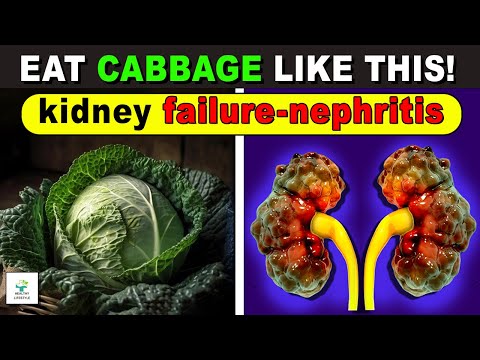 👉EATING CABBAGE LIKE THIS CAUSES KIDNEY FAILURE AND CHRONIC DISEASES  - Healthy lifestyle