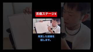 僕は舌癌ステージ4 #癌 #youtubeはじめました  #口腔外科