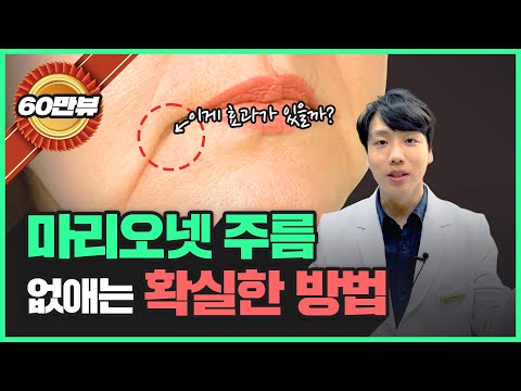 마리오네트 주름 확실한 예방법!! | 입꼬리 처짐, 심술보, 불독살