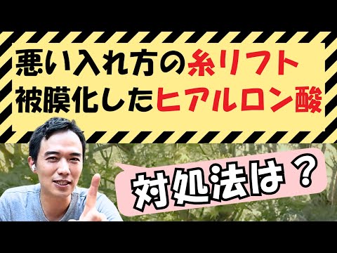 続・糸リフト・ヒアルロン酸、実際どうなっているの？