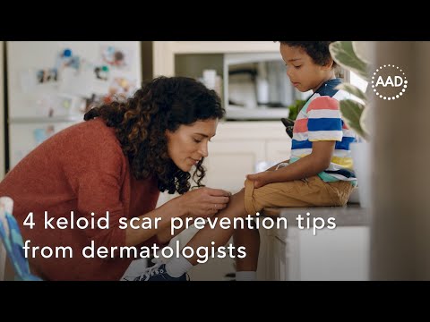 4 keloid scar prevention tips from dermatologists