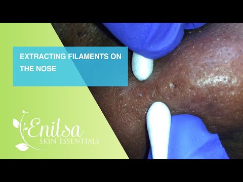 Extracting Filaments On The Nose