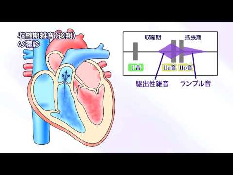 DVD『フィジカルアセスメントのための心音・肺音・腹音』　サンプル動画