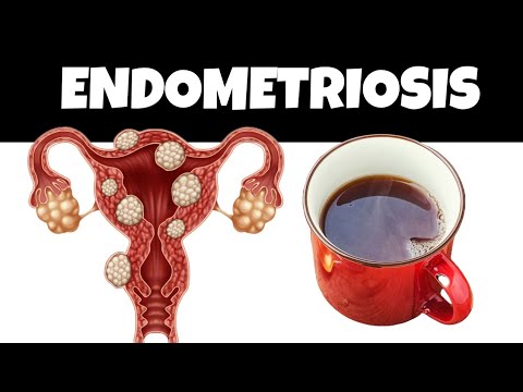 Shrink Your Endometriosis Cysts Fast : Drink 1 Cup Daily!