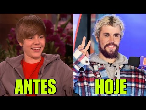 7 FAMOSOS que ESTÃO PERDENDO seus TRAÇOS DE ADOLESCENTES #2