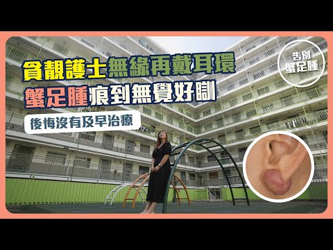 【告別蟹足腫】EP4 貪靚護士無緣再戴耳環｜蟹足腫痕到無覺好瞓｜後悔沒有及早治療