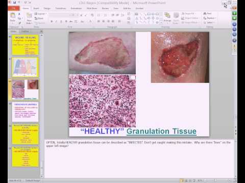 Medical School Pathology, 2013 Season, Session #5: Regeneration and Healing