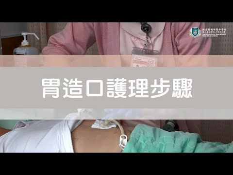 頭頸癌病患居家管路照護 - 胃造口【雙和醫院-癌症中心頭頸癌團隊】