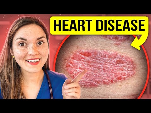 What Your SKIN Says About Your HEALTH - PART 2: Doctor Explains