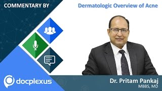 “Dermatologic Overview of Acne” by Dr.  Pritam Pankaj