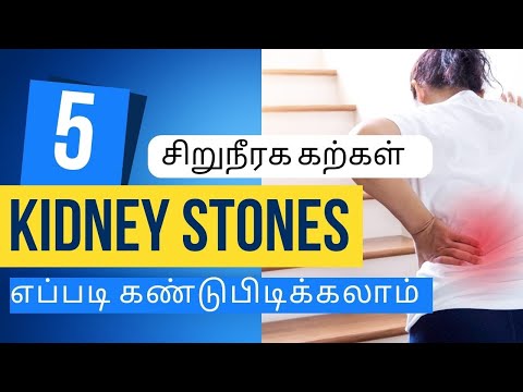 kidney stone symptoms in Tamil | kidney failure symptoms in tamil | kidney stones in tamil