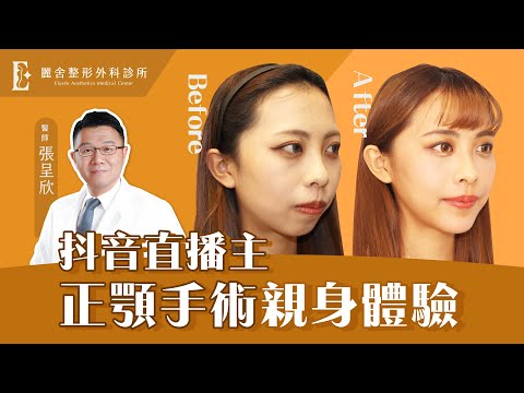 正顎手術心得分享【抖音直播主】暴牙+下巴後縮被網友嘲笑！成果意想不到！ 張呈欣醫師｜麗舍整形外科