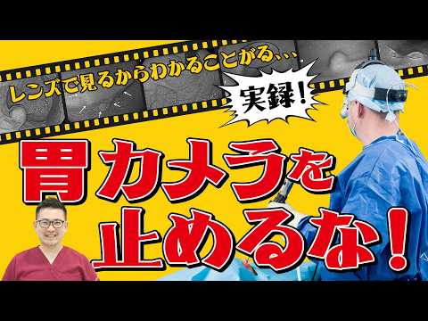 【バリウムでは見逃す!!】胃カメラでわかる！食道がん、胃がん以外に発見できる病気とは?  教えて久津川先生 No.455