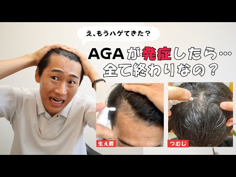 AGAが発症したら全て終わりなのか？ハゲはじめに知っておきたいことを20代で薄毛になったわたしが解説します。