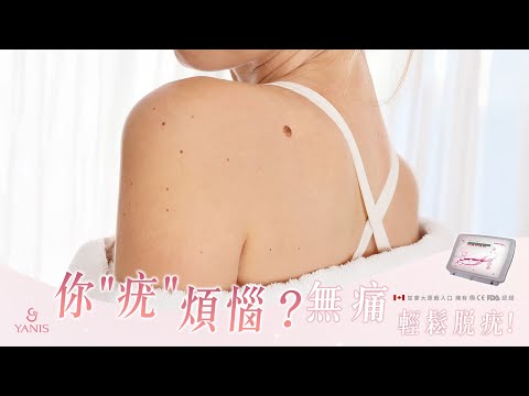 ❤️Yanis Beauty・「疣」煩惱❤️