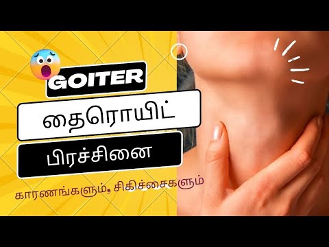 Thyroid goiter problem treatment in tamil | Thyroid problem in tamil | Thyroid treatment in tamil