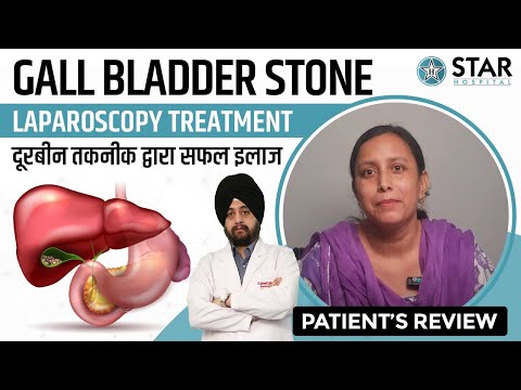 Best Hospital for Gall Bladder Stone in Hoshiarpur | Best Gall Bladder Doctor | Treatment