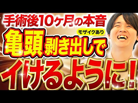 【包茎手術結果】遅漏が完全に治った！大満足の10ヶ月検診【若僧さん】