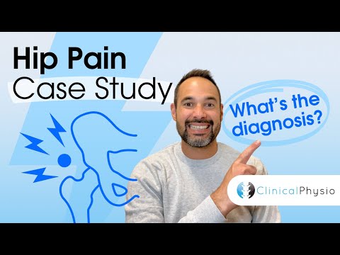 Hip Pain Case Study | Expert Physio Explains Hip Assessment and Diagnosis!