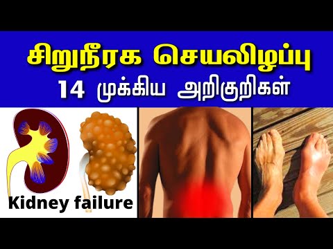 சிறுநீரகம் செயலிழப்பு 14 அறிகுறிகள்| Kidney failure symptoms | Kidney disease | kidney damage