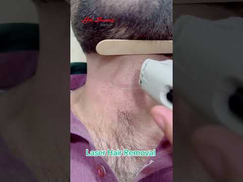 Laser Hair Removal #getsmarthairclub #viralvideo #viralshort