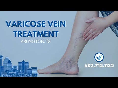 Our Vein Treatment Center in Arlington, TX