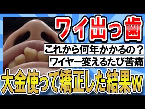 【2ch面白いスレ】ワイ大金を使って歯の矯正を決意ｗｗｗ【ゆっくり解説】