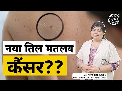 STOP Ignoring These MOLE Symptoms! | How to get rid of moles | Dadu Medical Centre