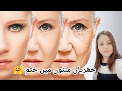 How to Get Rid of Wrinkles | Wrinkles Se Chutkara Paane Ke Asaan Tareeqay |