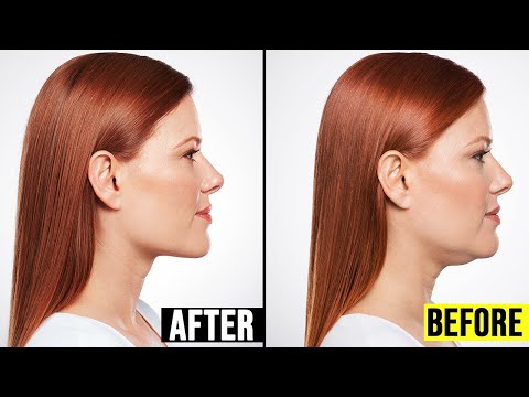 How to Lose Double Chin in 5 Days Without Exercise | Top 5.