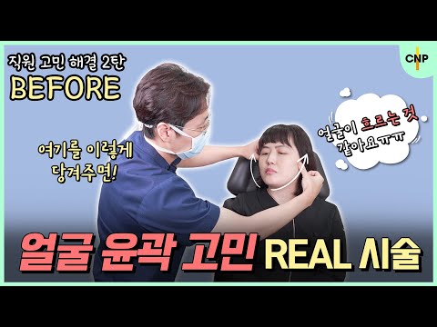 기미부터 얼굴 윤곽까지 한번에! 탄력과 색소를 모두 해결할 40대 동안시술 대공개! [직원 고민해결 2탄]