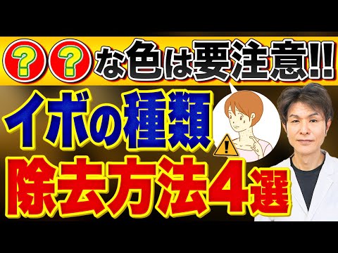 イボの取り方は？皮膚科専門医がわかりやすくイボに関する疑問を解消！イボの除去、原因、イボコロリなど