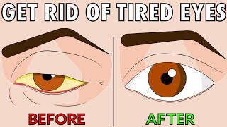 How to naturally get rid of tired eyes in 2 easy steps