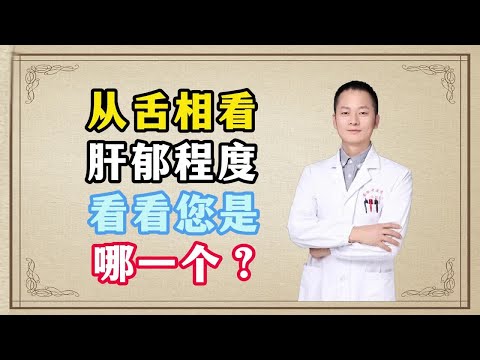 从舌象看肝郁程度，看看您是哪一个？