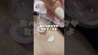 TikTok 600,000 views Can you get rid of belly button sesame seeds? I tried the latest pack and wow!