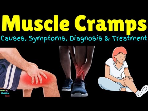 Muscle Spasms (Muscle Cramps): Causes, Signs, Symptoms, Diagnosis, Treatments and Prevention