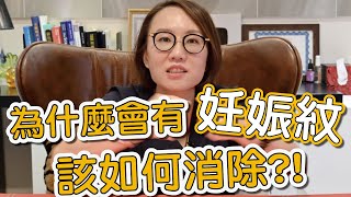 肚子有妊娠紋怎麼辦？讓莊醫師告訴你如何有效治療妊娠紋！