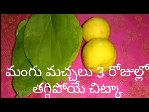 Best home remedies for mangu machhalu