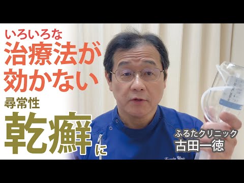 いろいろな治療法が効かない尋常性乾癬に〜古田一徳・ふるたクリニック