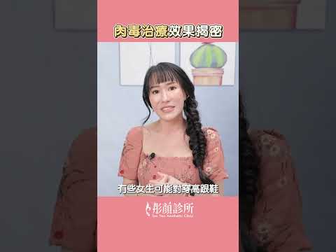 肉毒治療效果揭密  #Shorts