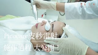 Picocare皮秒雷射施作過程 完整大公開 ! | 金芝妍醫美診所 洪睿醫師