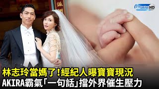 林志玲當媽了！AKIRA霸氣護妻「一句話」擋外界催生壓力　經紀人透露寶寶現況｜中時新聞網