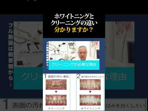 【歯科医が語る】歯のクリーニングはなぜ必要なのか？！