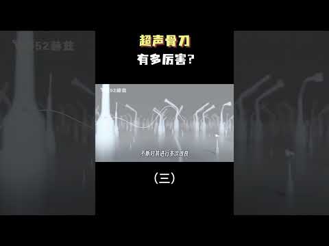 超声骨刀有多厉害？（三）