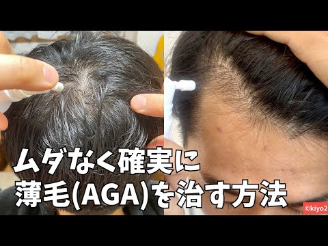 【永久保存版】薄毛・AGAを最短で確実に改善させる方法＆効果がないことまとめ