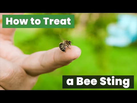 How to Treat a Bee Sting: Quick and Easy Method