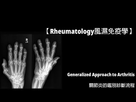 【Rheumatology風濕免疫學】Generalized Approach to Arthritis關節炎的鑑別診斷流程