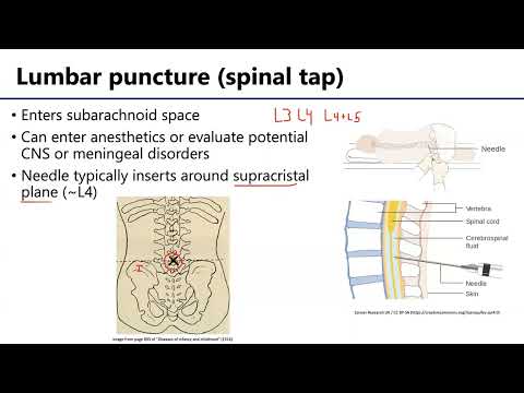 Back and Spinal Cord LO 5 - Meninges: Clinical Procedures